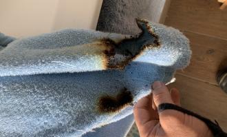 Burned dressing gown